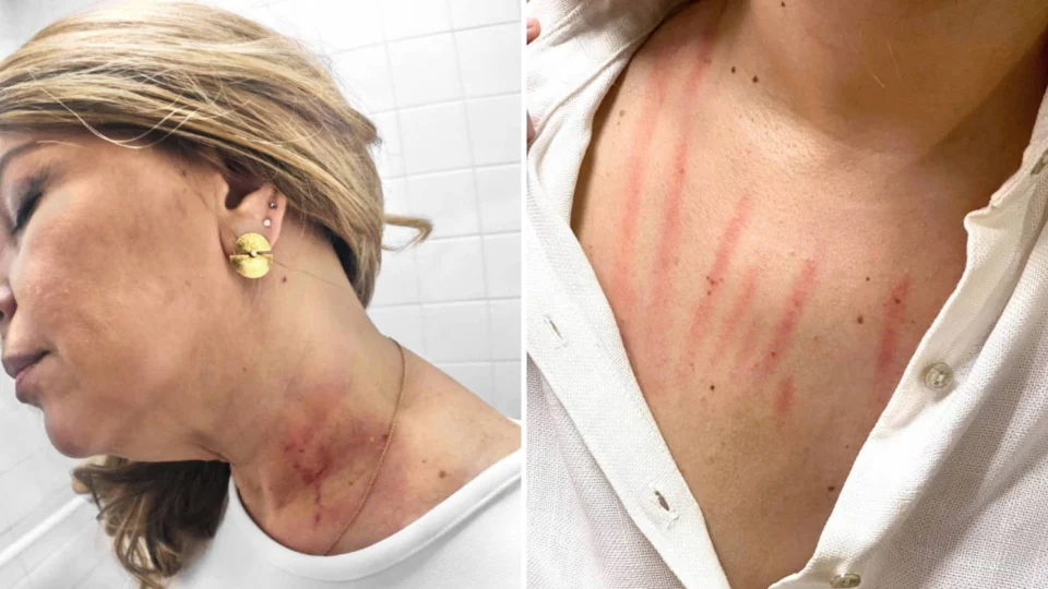 VÍDEO: Vereadora registra BO e diz que colega de partido tentou enforcá-la no banheiro da Câmara de SP