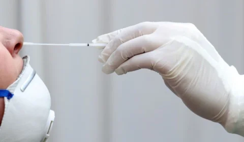 Amazonas confirma 109 novos casos de Covid-19 e 3 mortes