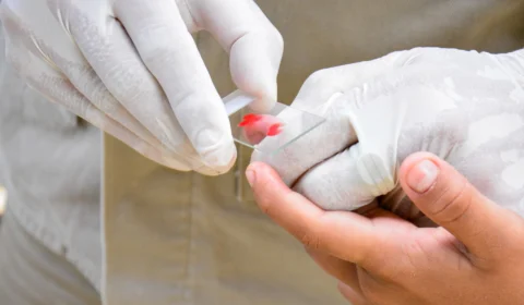 Em Manaus, “Dia da Malária nas Américas” será marcada com ações de educação em saúde