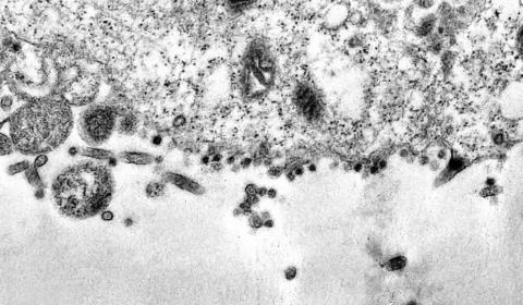 Nova variante do coronavírus é detectada na África do Sul