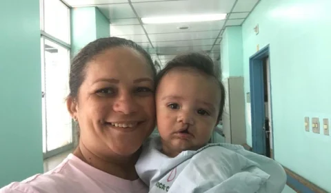 Mutirão de cirurgias de lábios leporinos e pediátricas será realizado em outubro em Manaus