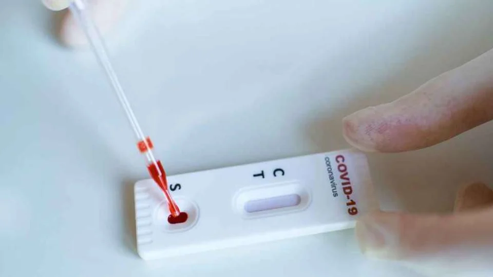 FVS informa o diagnóstico de 48 novos casos de Covid-19 e 2 mortes, no Amazonas