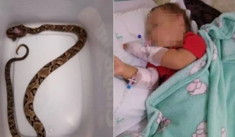 Bebê de 1 ano é picado por cobra jararaca em Santa Catarina