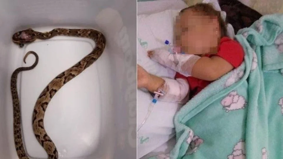 Bebê de 1 ano é picado por cobra jararaca em Santa Catarina