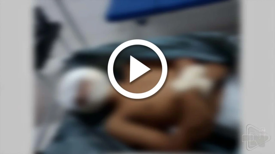 VÍDEO: adolescente morre após ser baleado na cabeça na Zona Norte de Manaus