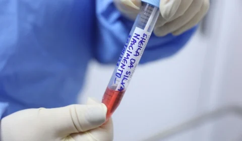 Mais de 3 mil novos casos de Covid são confirmados no AM, em 24 horas