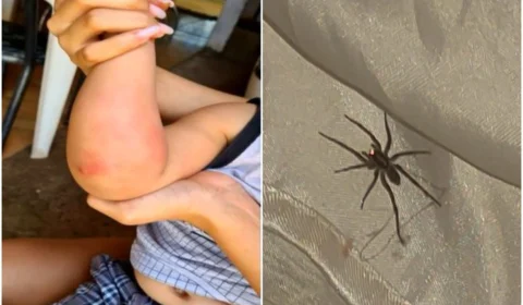 Criança de 2 anos é picada por aranha no berço, em Goiás