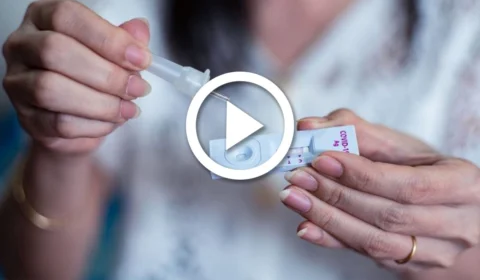 AO VIVO: Anvisa decide sobre liberação de autotestes de Covid-19