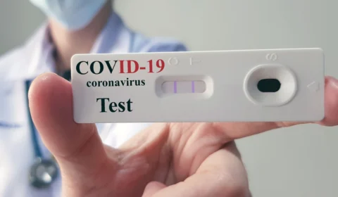 Ministério da Saúde prevê entrega de 13,1 milhôes de testes de Covid-19 aos estados