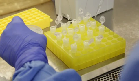 Avanço na medicina diminui resistência do vírus HIV