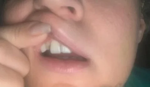 Polícia descarta agressão e conclui como ‘queda’ suposta agressão à deputada Joice