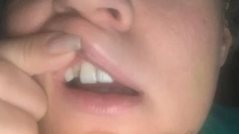 Polícia descarta agressão e conclui como ‘queda’ suposta agressão à deputada Joice