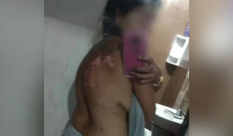 Por crise de ciúmes, homem joga óleo quente na própria companheira, em Goiás