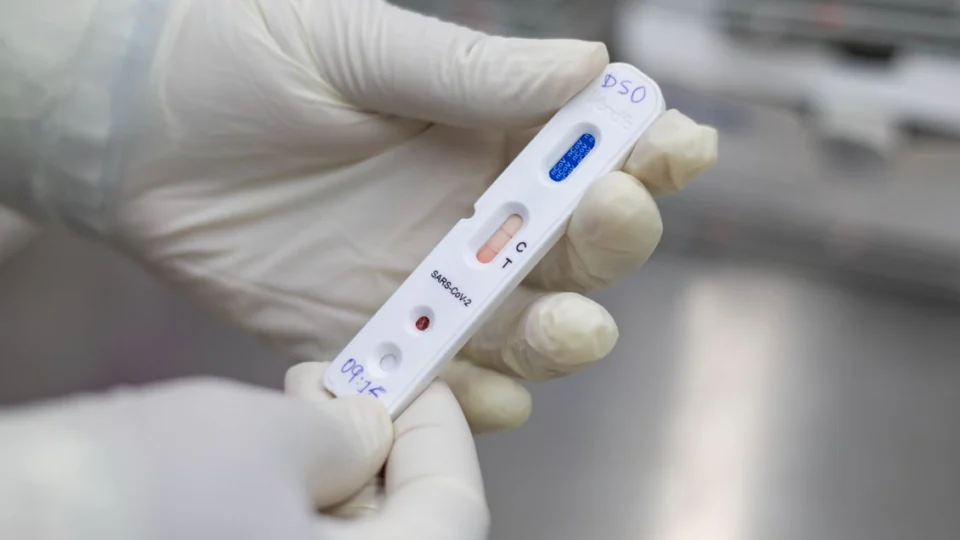 Amazonas registra 3 mortes e 177 novos casos de Covid-19