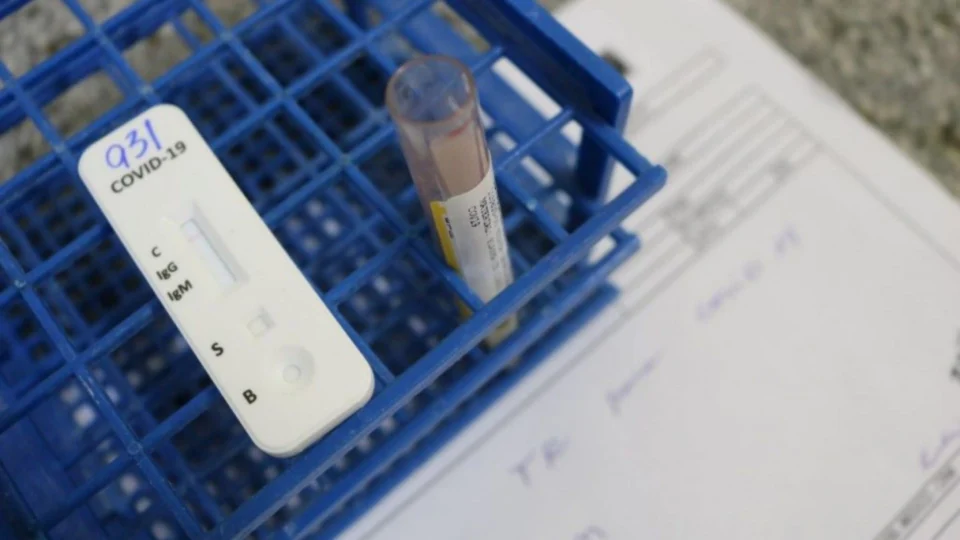 Flurona: AM tem mais 4 casos de coinfecção por Covid-19 e Influenza