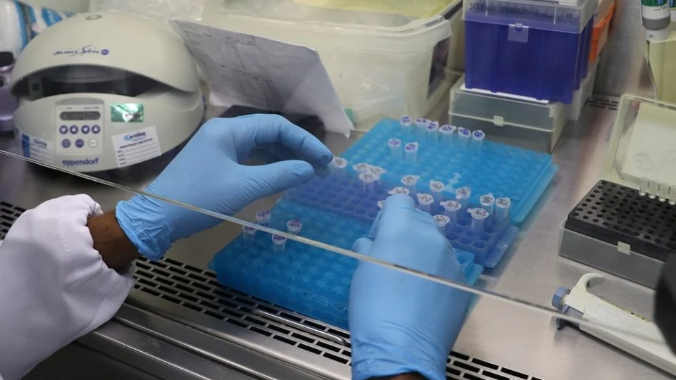 FVS-AM informa  o diagnóstico de 34 novos casos de Covid-19 e uma morte