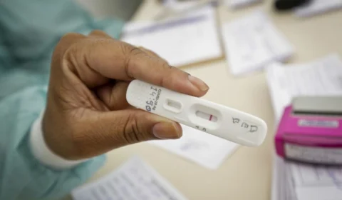 Anvisa concede primeiro registro de autoteste para Covid-19 no Brasil