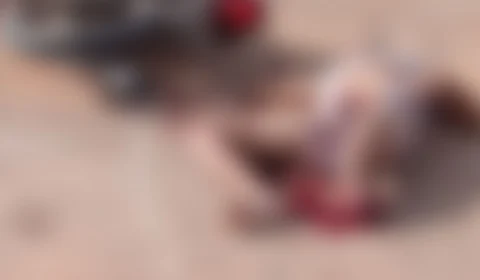 Jovem tem perna arrancada durante acidente de moto em Barreirinha-AM