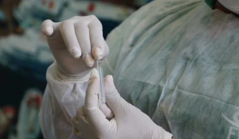 Amazonas registra 63 novos casos de Covid-19 e 2 mortes