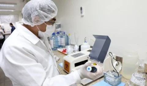 Amazonas registra 10 mortes e mais de 7 mil novos casos da Covid-19, confirma FVS-RCP