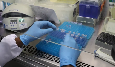 Em novo boletim, FVS informa o diagnóstico de 64 novos casos de Covid e uma morte no Amazonas