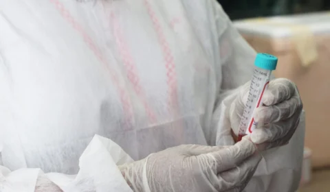 Amazonas registra duas mortes e mais 79 novos casos de Covid-19, informa FVS-RCP