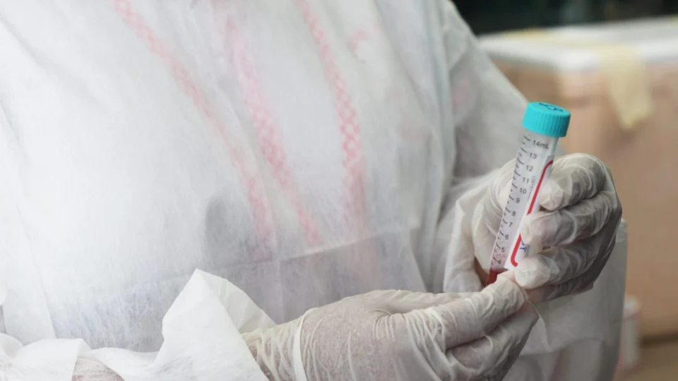 Amazonas registra duas mortes e mais 79 novos casos de Covid-19, informa FVS-RCP