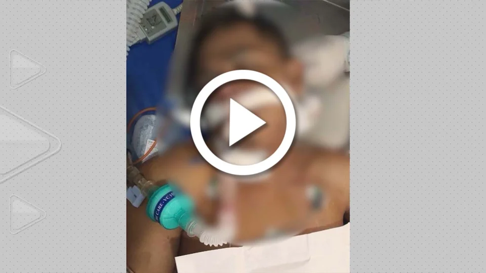 VÍDEO: homem sofre traumatismo craniano ao cair de muro em Parintins-AM