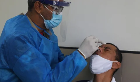 FVS-AM informa 178 novos casos de Covid-19 e 3 mortes pela doença