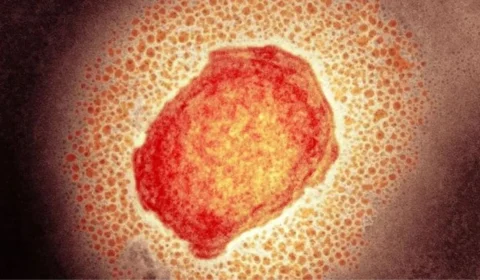 Peru registra primeira morte de paciente com monkeypox