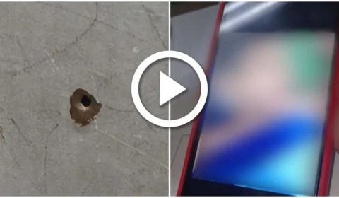 VÍDEO: criança de 6 anos é vítima de bala perdida na Zona Sul de Manaus