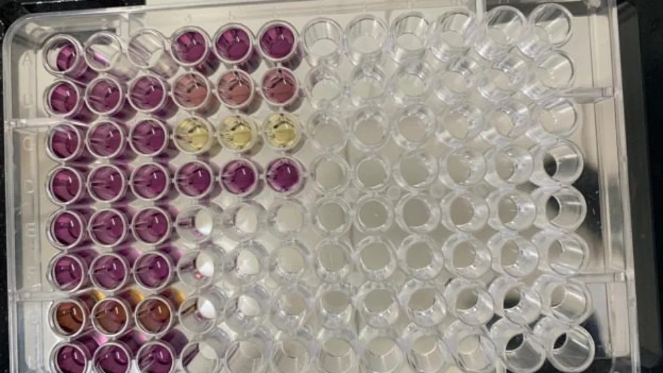 Estudo investiga espécies de cogumelos capazes de auxiliar no combate a doenças, no AM