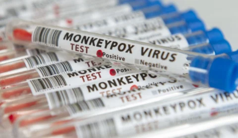 Monkeypox em Manaus: paciente com varíola dos macacos está isolado em casa