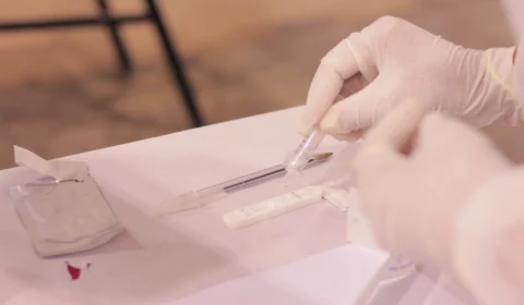 Amazonas registra 836 novos caso de Covid-19 e uma morte, em 24h