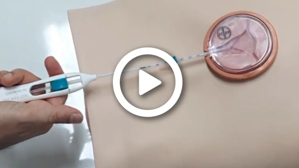 VÍDEO: cresce o número de procura por mulheres de Manaus pelo DIU