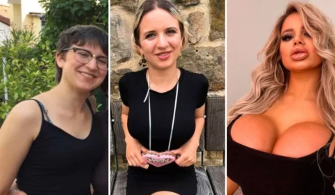 Modelo do Onlyfans quer ter maiores seios do mundo após gastar R$ 315 mil reais em plásticas