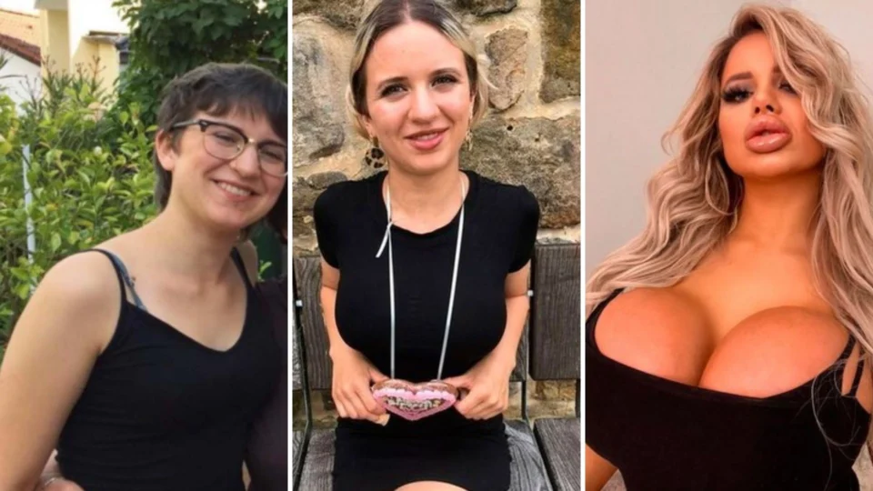 Modelo do Onlyfans quer ter maiores seios do mundo após gastar R$ 315 mil reais em plásticas