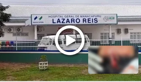 VÍDEO: funcionário de hospital é atingido com facada na cabeça durante tentativa de assalto no interior do AM