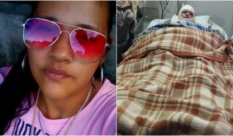 Ao acordar de coma, jovem acusa marido de atear fogo nela e morre logo em seguida, no MS