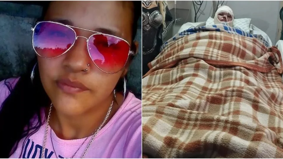 Ao acordar de coma, jovem acusa marido de atear fogo nela e morre logo em seguida, no MS