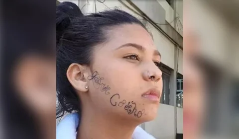 Jovem inicia processo de remoção de tatuagem no rosto feita pelo ex-namorado: ‘sensação de alívio’
