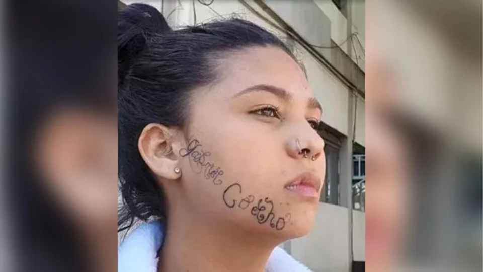 Jovem inicia processo de remoção de tatuagem no rosto feita pelo ex-namorado: ‘sensação de alívio’