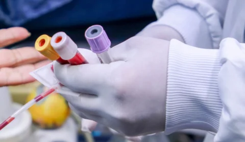 Ministério da Saúde alerta nível máximo de transmissão da varíola dos macacos no Brasil