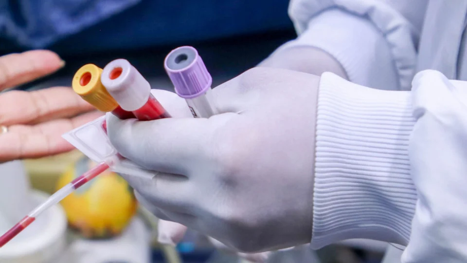 Ministério da Saúde alerta nível máximo de transmissão da varíola dos macacos no Brasil