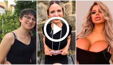 VÍDEO: modelo do Onlyfans mostra antes e depois de plásticas no valor de R$ 315 mil