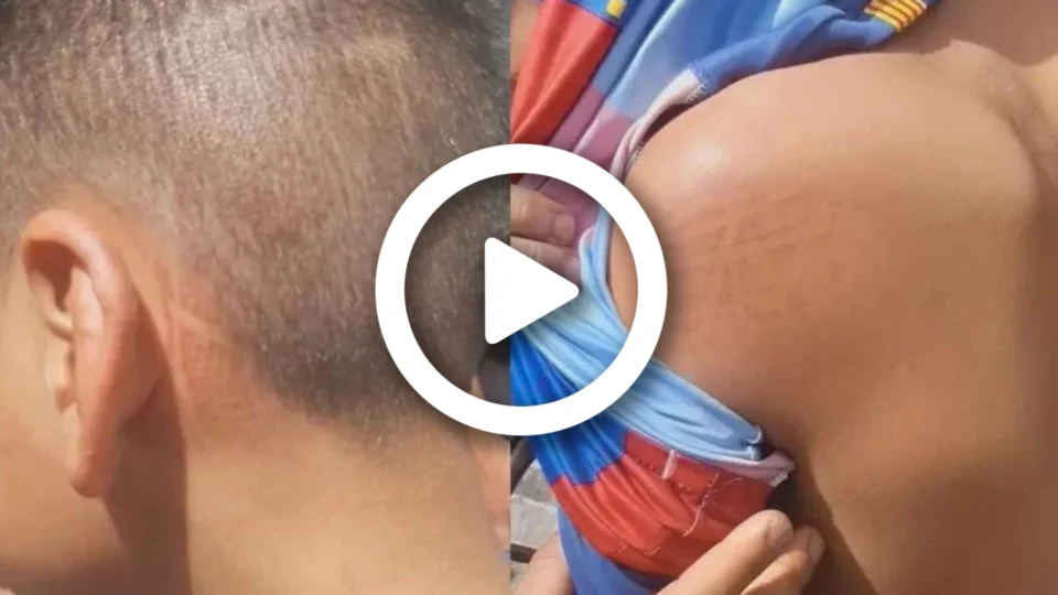 VÍDEO: adolescente de 14 anos é agredido por vizinho em Brasília