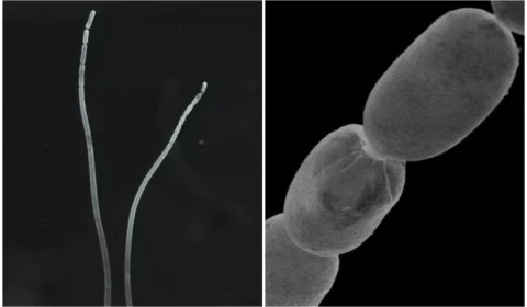 Cientistas descobrem maior bactéria já encontrada na natureza que pode ser vista a olho nu