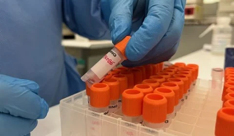 Monkeypox: Amazonas tem 26 casos suspeitos e 37 casos confirmados de varíola dos macacos