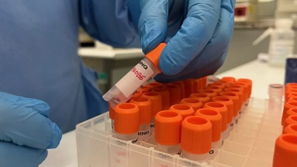 Monkeypox: Amazonas tem 26 casos suspeitos e 37 casos confirmados de varíola dos macacos