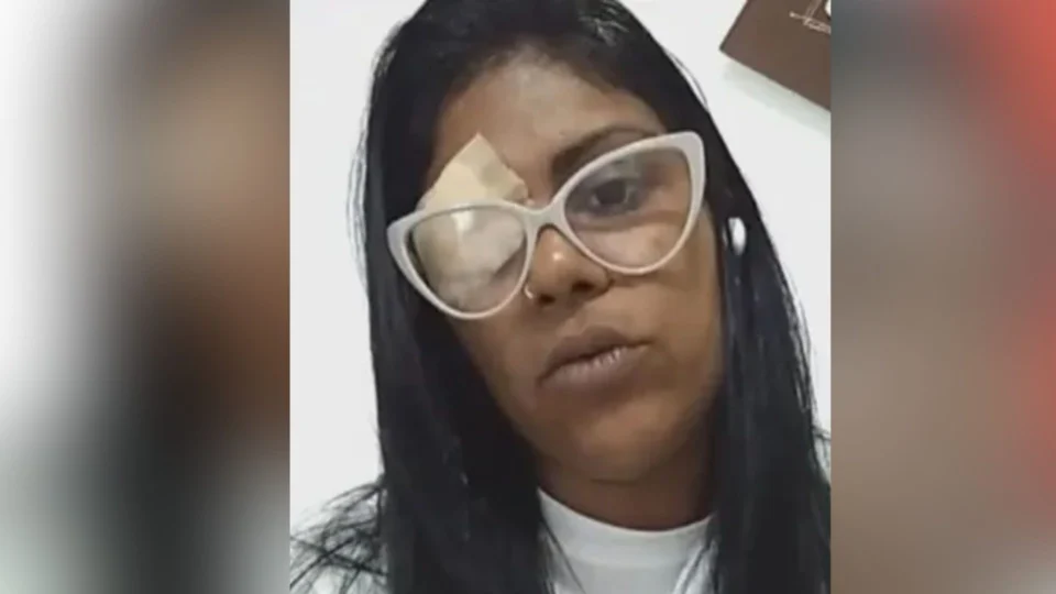 Mulher perde visão do olho direito após agressor se irritar com samba em homenagem a Exu, no RJ